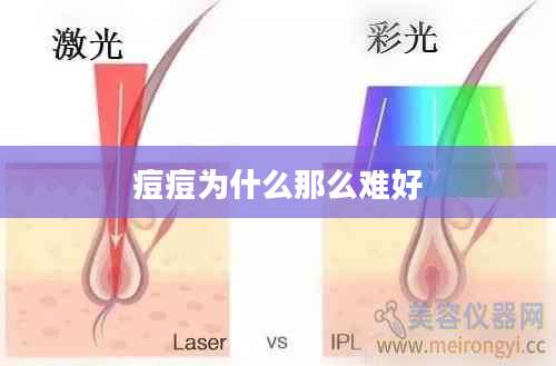 痘痘为什么那么难好