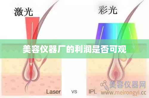 美容仪器厂的利润是否可观