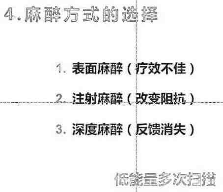 鍏充簬灏勯缇庡浠櫒鐨勭浉鍏崇煡璇嗛兘鍦ㄨ繖鍎夸簡