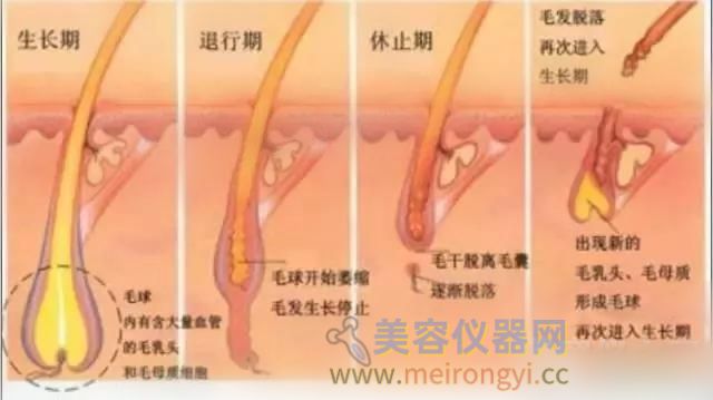 夏季就要“***光”——opt脱毛仪原理功效