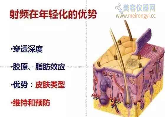 鍏充簬灏勯缇庡浠櫒鐨勭浉鍏崇煡璇嗛兘鍦ㄨ繖鍎夸簡