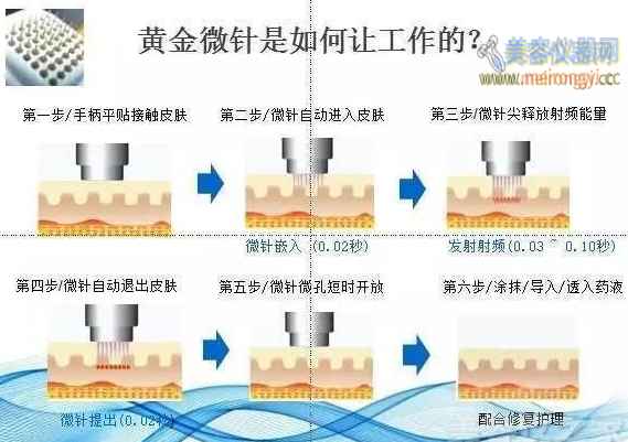 鍏充簬灏勯缇庡浠櫒鐨勭浉鍏崇煡璇嗛兘鍦ㄨ繖鍎夸簡