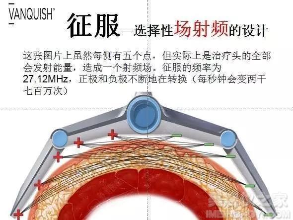 鍏充簬灏勯缇庡浠櫒鐨勭浉鍏崇煡璇嗛兘鍦ㄨ繖鍎夸簡