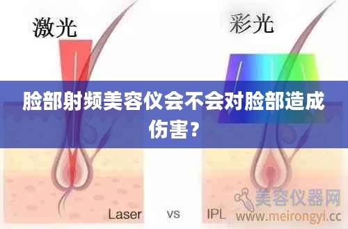 脸部射频美容仪会不会对脸部造成伤害？