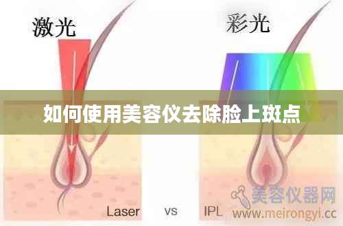 如何使用美容仪去除脸上斑点