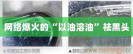 网络爆火的“以油溶油”祛黑头