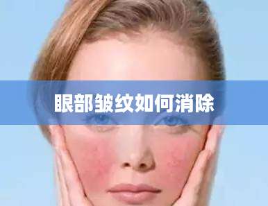 眼部皱纹如何消除